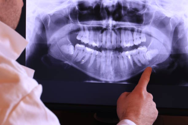 Best Emergency Root Canal Treatment in Brown Station, MD