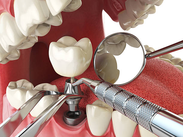 Best Emergency Treatment for Toothache in Brown Station, MD