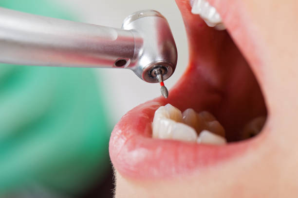 Best Emergency Broken Tooth Repair in Brown Station, MD